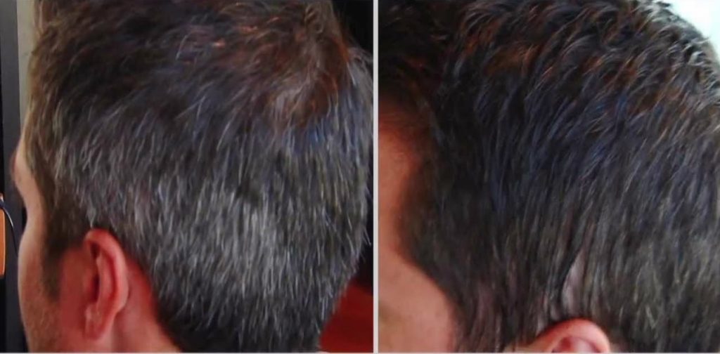 Reverse Gray Hair